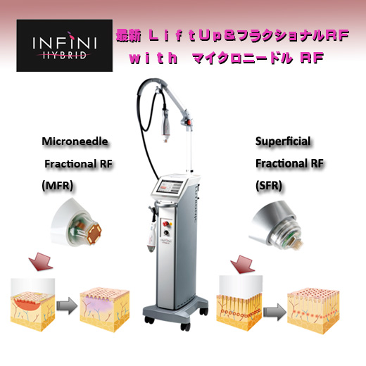インフィニ