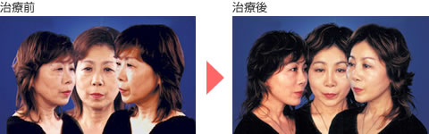 症例写真